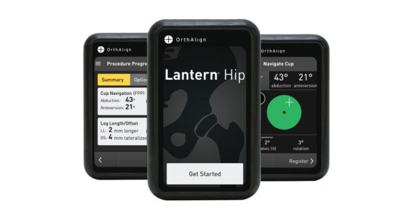 OrthAlign Receives FDA 510(k) Clearance for Lantern® Hip